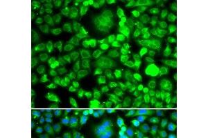 Immunofluorescence analysis of MCF-7 cells using BLID Polyclonal Antibody (BLID Antikörper)