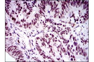 Image no. 2 for anti-Forkhead Box P1 (FOXP1) antibody (ABIN1491561) (FOXP1 Antikörper)