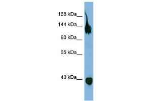 WB Suggested Anti-SEMA6A  Antibody Titration: 0.