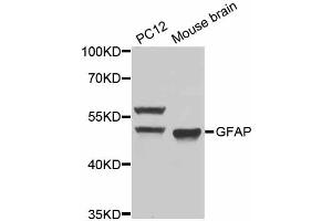 Western blot analysis of extracts of various cell lines, using GFAP antibody (ABIN5970067) at 1/1000 dilution. (GFAP Antikörper)