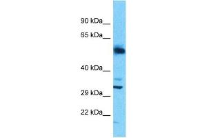 Host:  Rabbit  Target Name:  SLC25A30  Sample Type:  Uterus Tumor lysates  Antibody Dilution:  1. (SLC25A30 Antikörper  (N-Term))