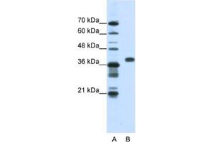 Western Blotting (WB) image for anti-Poly(rC) Binding Protein 1 (PCBP1) antibody (ABIN2462201) (PCBP1 Antikörper)