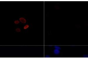 Immunofluorescence analysis of C6 cells treated by TSA (upper left) and untreated C6 cells (upper right) using Acetyl-Histone H4-K16 Polyclonal Antibody at dilution of 1:100.