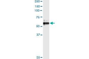 Immunoprecipitation (IP) image for anti-Matrix Metallopeptidase 13 (Collagenase 3) (MMP13) (AA 362-471) antibody (ABIN517973)