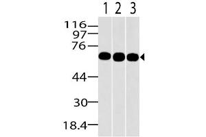 Image no. 1 for anti-Methyl-CpG Binding Domain Protein 1 (MBD1) (AA 291-586) antibody (ABIN5027347) (MBD1 Antikörper  (AA 291-586))