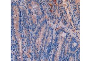 IHC-P analysis of Kidney tissue, with DAB staining. (UMPS Antikörper  (AA 311-481))