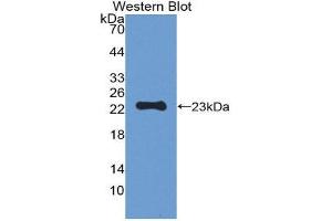 Western Blotting (WB) image for anti-Peroxiredoxin 1 (PRDX1) (AA 1-199) antibody (Biotin) (ABIN1175813) (Peroxiredoxin 1 Antikörper  (AA 1-199) (Biotin))
