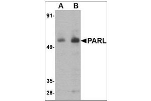 Western blot analysis of PARL in 3T3 cell lysate with PARL antibody at (A) 1 and (B) 2 µg/ml. (PARL Antikörper  (N-Term))