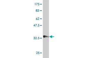 Western Blot detection against Immunogen (34. (HAND2 Antikörper  (AA 135-216))