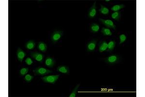 Immunofluorescence of monoclonal antibody to SMAD4 on HeLa cell. (SMAD4 Antikörper  (AA 1-552))
