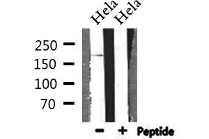 Western blot analysis of extracts from Hela, using BCOR Antibody.