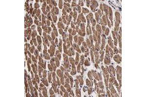 Immunohistochemical staining of human heart muscle with PSMA3 polyclonal antibody  shows moderate cytoplasmic positivity in myocytes. (PSMA3 Antikörper)