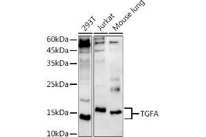 Western blot analysis of extracts of various cell lines, using TGFA antibody (ABIN3020947, ABIN3020948, ABIN3020949, ABIN1513602 and ABIN6213813) at 1:500 dilution. (TGFA Antikörper  (AA 24-98))