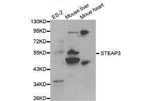 Western blot analysis of extracts of various cell lines, using STEAP3 antibody. (STEAP3 Antikörper)