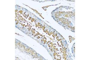 Immunohistochemistry of paraffin-embedded rat testis using HPX antibody. (Hemopexin Antikörper  (AA 24-245))