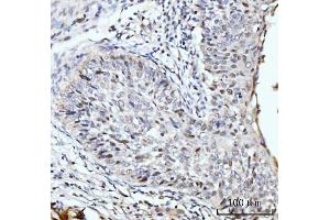 IHC analysis of SBNO1 using anti-SBNO1 antibody (ABIN7601710). (SBNO1 Antikörper  (AA 43-1303))