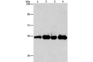Western Blot analysis of Human bladder carcinoma tissue and A172 cell, Human fetal brain tissue and hela cell using PDE4D Polyclonal Antibody at dilution of 1:500 (PDE4D Antikörper)