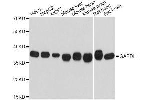 Western blot analysis of extracts of various cell lines, using GAPDH antibody. (GAPDH Antikörper)