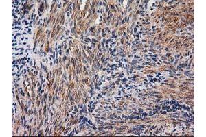 Immunohistochemical staining of paraffin-embedded Human endometrium tissue using anti-NNMT mouse monoclonal antibody. (NNMT Antikörper)