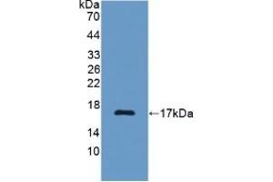 Detection of Recombinant C7, Rat using Polyclonal Antibody to Complement Component 7 (C7) (C7 Antikörper  (AA 1-144))