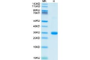 Human BTN3A2 on Tris-Bis PAGE under reduced condition. (BTN3A2 Protein (AA 30-248) (His-Avi Tag))