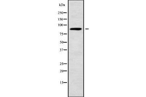 Western blot analysis NUP88 using COLO205 whole cell lysates