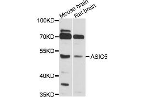 Western blot analysis of extract of mouse brain and rat brain cells, using ASIC5 antibody. (ACCN5 Antikörper)
