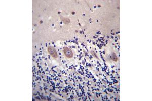 CACNA2D2 Antibody (Center) (ABIN657303 and ABIN2846384) immunohistochemistry analysis in formalin fixed and paraffin embedded human cerebellum tissue followed by peroxidase conjugation of the secondary antibody and DAB staining. (CACNA2D2 Antikörper  (AA 643-671))