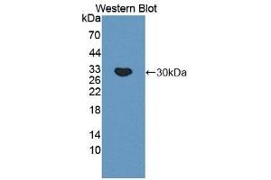Detection of Recombinant C4BPa, Mouse using Polyclonal Antibody to C4 Binding Protein Alpha (C4BPa) (C4BPA Antikörper  (AA 57-306))