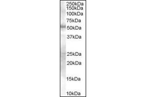 Image no. 1 for anti-SMAD Family Member 9 (SMAD9) (Internal Region) antibody (ABIN372891) (SMAD9 Antikörper  (Internal Region))