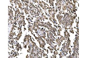 IHC analysis of NOLA1/GAR1 using anti-NOLA1/GAR1 antibody (ABIN7602076). (GAR1 Antikörper  (AA 58-165))