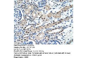 Rabbit Anti-IGSF1 Antibody  Paraffin Embedded Tissue: Human Kidney Cellular Data: Epithelial cells of renal tubule Antibody Concentration: 4. (IGSF1 Antikörper  (N-Term))