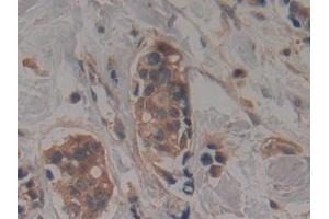 Immunohistochemistry (IHC) image for anti-Mps1 (TTK) (AA 532-786) antibody (ABIN7443260)