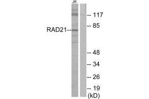 Western blot analysis of extracts from Jurkat cells, using RAD21 antibody. (RAD21 Antikörper)