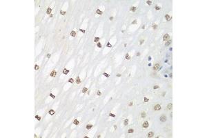 Immunohistochemistry of paraffin-embedded human esophagus using FOSL2 antibody (ABIN3016548, ABIN3016549, ABIN3016550 and ABIN6219779) at dilution of 1:100 (40x lens). (FOSL2 Antikörper  (AA 187-326))