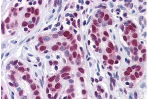 Human Breast: Formalin-Fixed, Paraffin-Embedded (FFPE) (ELAVL1 Antikörper  (AA 1-101))