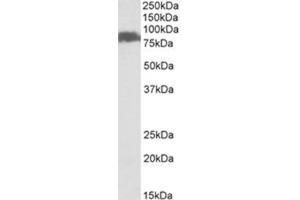 Western Blotting (WB) image for anti-Solute Carrier Family 26, Member 6 (SLC26A6) (Internal Region) antibody (ABIN1449464) (SLC26A6 Antikörper  (Internal Region))