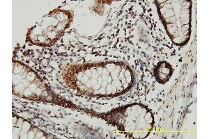 Immunoperoxidase of monoclonal antibody to CSTB on formalin-fixed paraffin-embedded human colon tissue. (CSTB Antikörper  (AA 1-98))