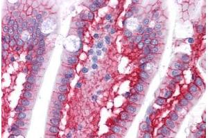 Human Small Intestine: Formalin-Fixed, Paraffin-Embedded (FFPE) (CTNNB1 Antikörper)