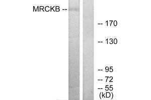 Western Blotting (WB) image for anti-CDC42 Binding Protein Kinase beta (DMPK-Like) (CDC42BPB) (C-Term) antibody (ABIN1850128) (CDC42BPB Antikörper  (C-Term))