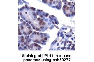 Image no. 1 for anti-Lipin 1 (LPIN1) (AA 300-400), (Internal Region) antibody (ABIN363586) (Lipin 1 Antikörper  (Internal Region))