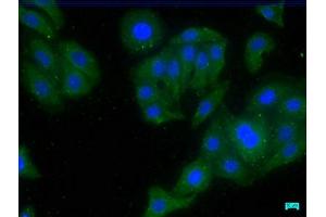 Immunofluorescence staining of HepG2 cells with ABIN7147234 at 1:50, counter-stained with DAPI. (CDK5RAP3 Antikörper  (Regulatory Subunit))