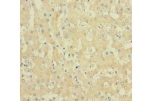 Immunohistochemistry of paraffin-embedded human liver tissue using ABIN7152719 at dilution of 1:100 (FTL Antikörper  (AA 2-175))