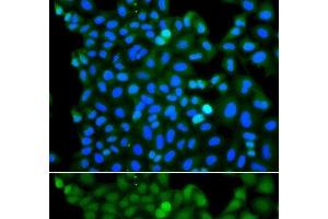 Immunofluorescence analysis of A549 cells using RNF125 Polyclonal Antibody (RNF125 Antikörper)