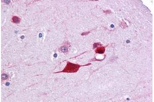 Human Brain, Cortex: Formalin-Fixed, Paraffin-Embedded (FFPE) (FABP4 Antikörper  (AA 71-120))