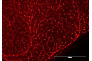 Immunofluorescence Microscopy of Chicken Anti-RFP antibody. (RFP Antikörper  (Biotin))