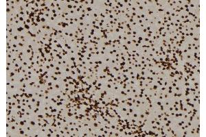 Immunohistochemistry (IHC) image for anti-Protein Phosphatase 3, Catalytic Subunit, alpha Isoform (PPP3CA) (N-Term) antibody (ABIN6264395)