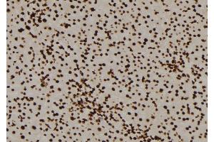 ABIN6276477 at 1/100 staining Mouse liver tissue by IHC-P.