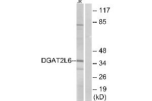 Western blot analysis of extracts from Jurkat cells, using DGAT2L6 antibody. (DGAT2L6 Antikörper)