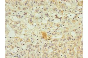 Immunohistochemistry of paraffin-embedded human adrenal gland tissue using ABIN7169349 at dilution of 1:100